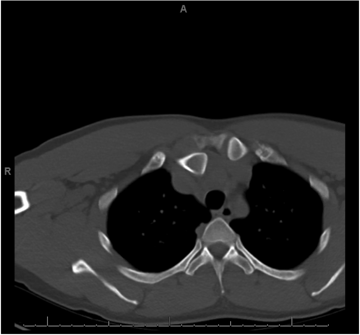 ct-chest-1.png